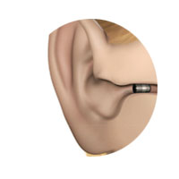 Hearing aids in kota